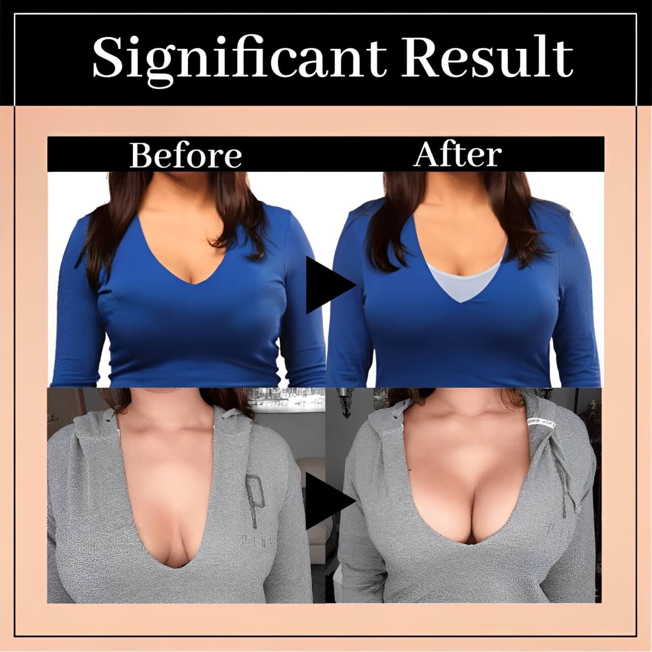 Formivelle Posture Bra Wireless Lift Up